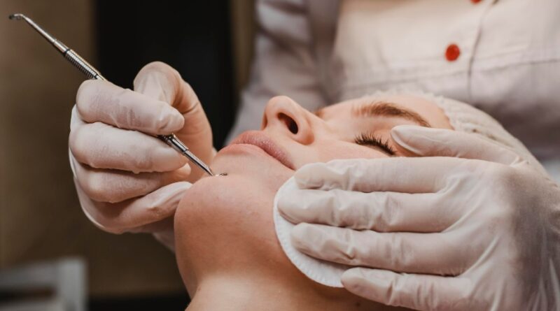 How Professional Treatments Help Clear Blackheads Safely