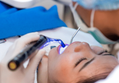 What Issues Can Be Corrected with Teeth Bonding Treatment
