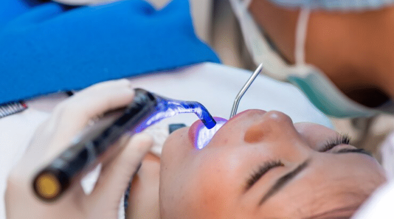 What Issues Can Be Corrected with Teeth Bonding Treatment