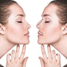 What Makes Dubai the Go-To Destination for Nose Surgery?